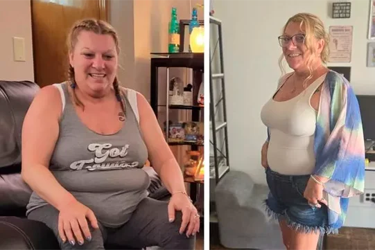 Antes e depois de aluna do método