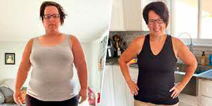 Antes e depois de aluna do método